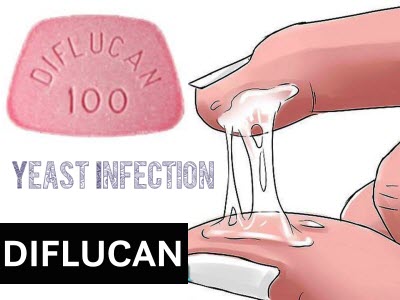 Diflucan use during pregnancy and lactation